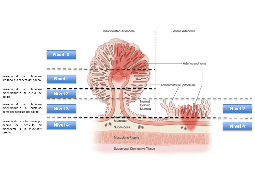 ENDIBA - Herramientas para Endoscopistas